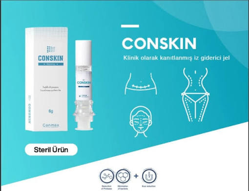 Conskin